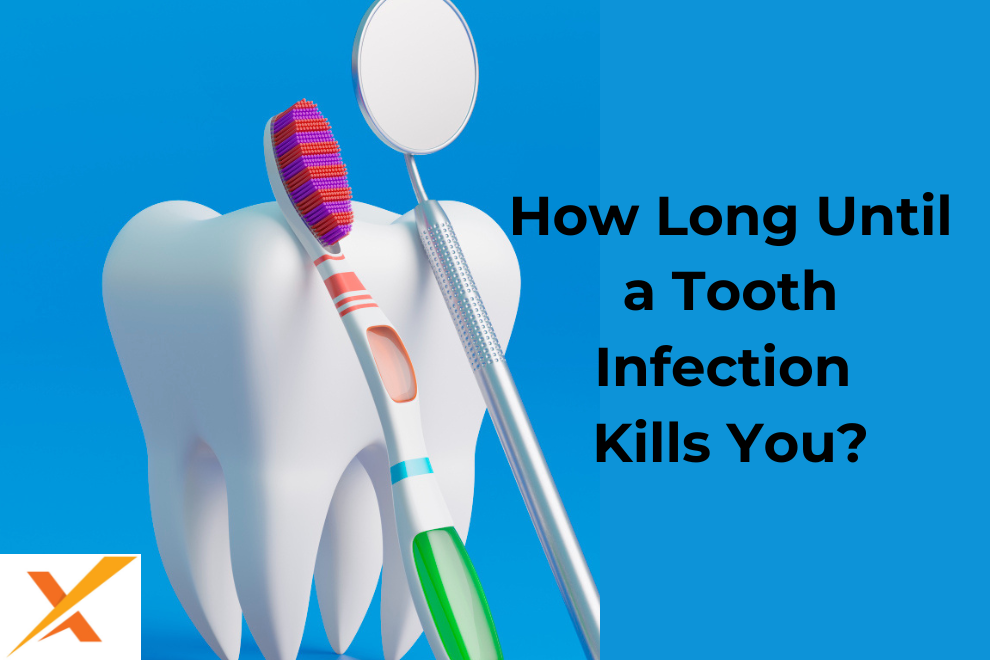 How Long Until a Tooth Infection Kills You?